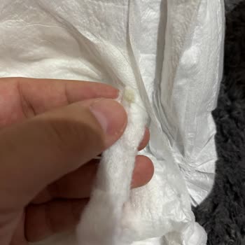 Sleepy Bebekte Yapışkan Silikon Parçaları Bulunması Sağlık Endişesi