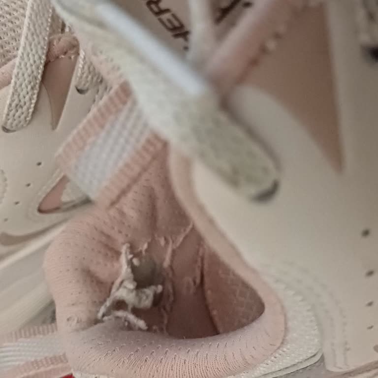 Skechers’te Kullanıcı Hatası Olarak Red Edilen Ürün Sorunları Ve İade Zorluğu