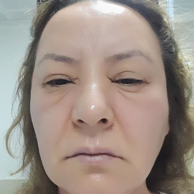 Kurtuluş Orman Çiftliği Alerjik Reaksiyon Sonrası İade Talebinin Reddedilmesi!