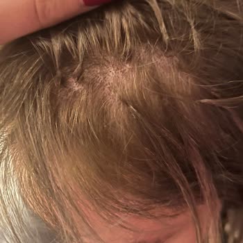 Ali Gür Kuaför Hayalet Kaynak İşleminden Hiçbir Şekilde Memnun Kalmadım!