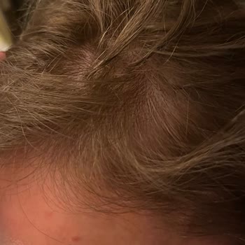 Ali Gür Kuaför Hayalet Kaynak İşleminden Hiçbir Şekilde Memnun Kalmadım!