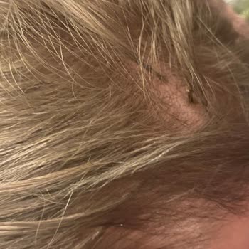 Ali Gür Kuaför Hayalet Kaynak İşleminden Hiçbir Şekilde Memnun Kalmadım!