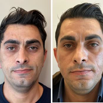 118.000 TL'lik Dermatoloji Tedavisinde Sonuç Yok, İade Talebi