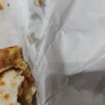 Yemeksepeti Hijyen İhlali: Salata Ve Lahmacunda Kıl