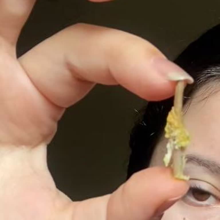 Coffy Sandviçinde Uzun Sivri Uçlu Kemik Çıktı