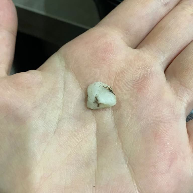 Pilavda Taş Çocukların Hayatını Tehdit Etti