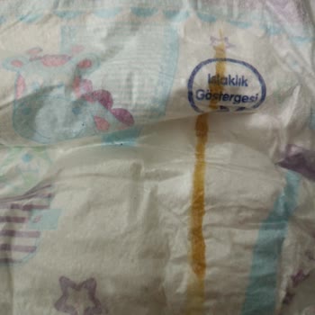 Molfix Junior Bebek Bezinde Lekeler Ve Yapışkan Kalıntılar