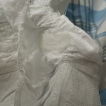 Molfix Junior Bebek Bezinde Lekeler Ve Yapışkan Kalıntılar