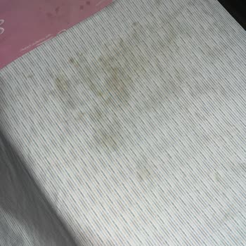 Ütü, İki Kullanımda Kahverengi Lekeler Bıraktı Ve Servis Sorunu Görmezden Geldi