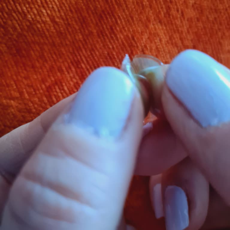 Hypnose Lens Kalite Sorunu Ve Firmadan Suçlamalar