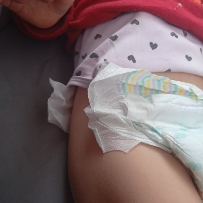 Cırtları Kopan Bebek Bezleri Kullanım Sorunu Ve Ücret İadesi Talebi