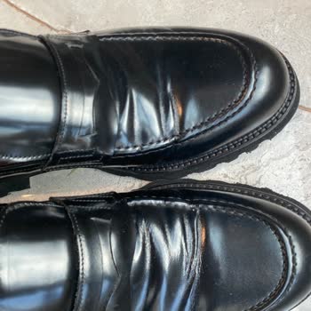 Bir Ayakkabı Eksik, Diğerinde Çatlak Ve Çözüm Bekliyor