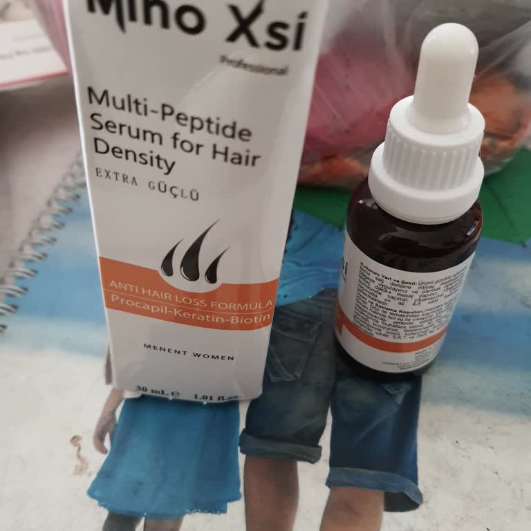 Minoxsisamp Saç Serumu Ve Şampuan Hiçbir İşe Yaramadı!