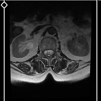 Ortopedi Doktorunun Hastasız MR Sonuçlarını Verme İsteğine Reddetmesi