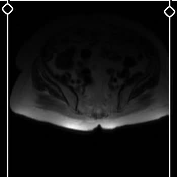 Ortopedi Doktorunun Hastasız MR Sonuçlarını Verme İsteğine Reddetmesi
