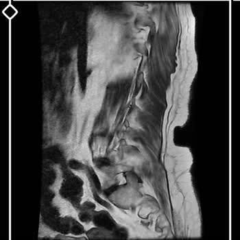 Ortopedi Doktorunun Hastasız MR Sonuçlarını Verme İsteğine Reddetmesi