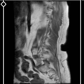 Ortopedi Doktorunun Hastasız MR Sonuçlarını Verme İsteğine Reddetmesi