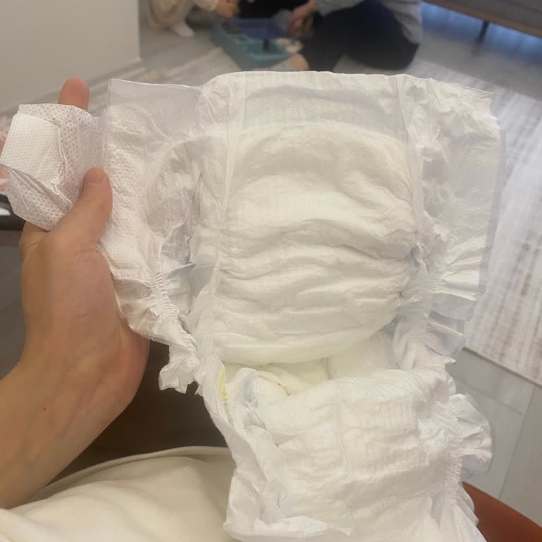 Molfix 5 Numaralı Bebek Bezlerinde Sürekli Cırt Eksikliği Ve Güven Kaybı