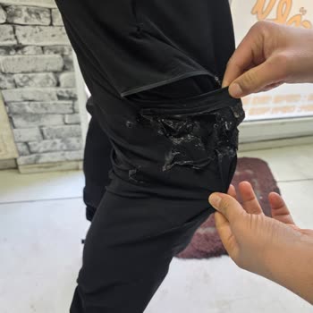 Patlayan Çakmak Yanık Ve Yangın Tehdidi