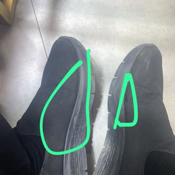 Skechers Ayakkabının Yanlardan Açılması Ve Değişim Talebinin Reddedilmesi