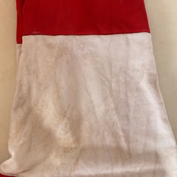 SEG Çamaşır Makinesi Temizlemiyor, Kıyafetleri Yağ Lekesi Ve Yırtıyor; Servis Randevusu Erteleniyor