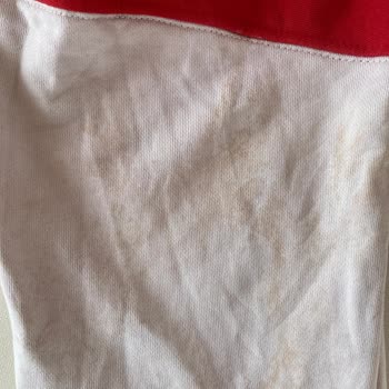 SEG Çamaşır Makinesi Temizlemiyor, Kıyafetleri Yağ Lekesi Ve Yırtıyor; Servis Randevusu Erteleniyor