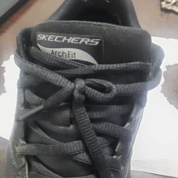 Skechers Ayakkabısında Kısa Sürede Topuk Deformasyonu Ve Üretici Hatasızlık İddiası