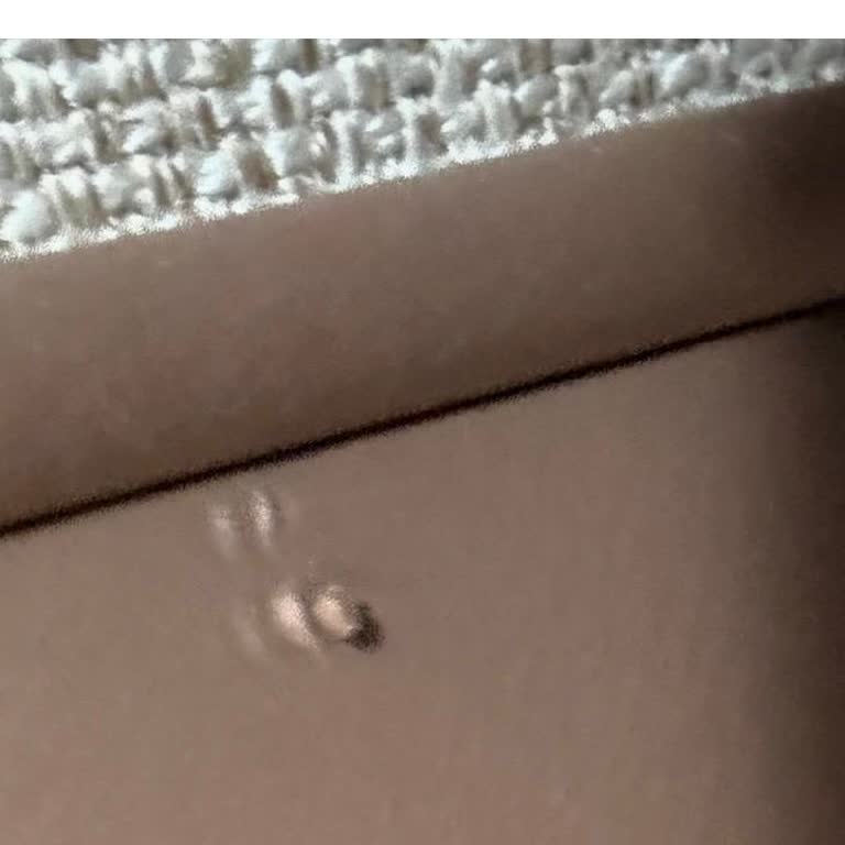 Yatsan Bazasının Kalitesiz Kaplaması Ve Garanti Reddi