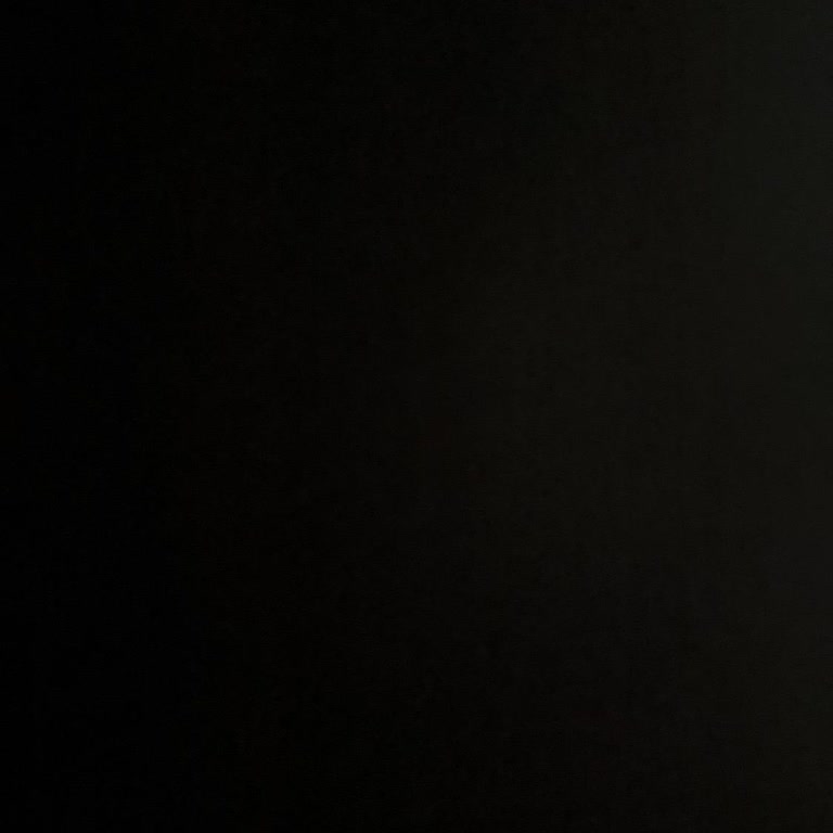 Pronet Ekipmanlarının Kurulmaması Ve Takip Eksikliği