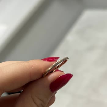 Pembe Taşlı Yüzükte Kararma Ve Soyulma, Dayanıklılık Sözü Boşa Çıktı