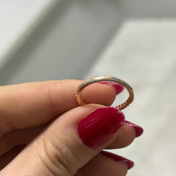 Pandora Refused a Refund After My Ring Caused Skin Discoloration and Allergy