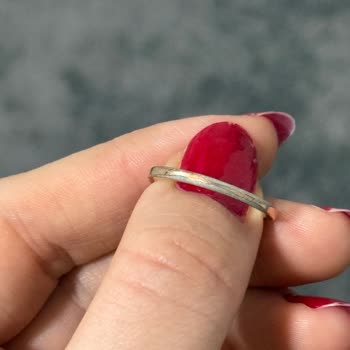 Pandora Refused a Refund After My Ring Caused Skin Discoloration and Allergy