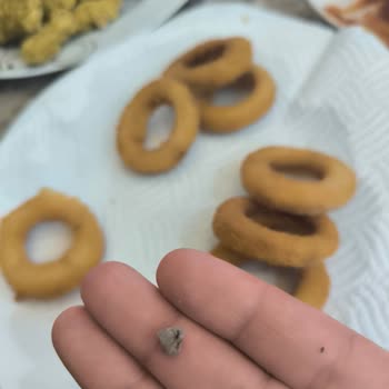 BİM'den Mutfağım Soğan Halkasında Taş Parçası: Çocuğumun Dişi Ağrıyor