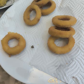 BİM'den Mutfağım Soğan Halkasında Taş Parçası: Çocuğumun Dişi Ağrıyor