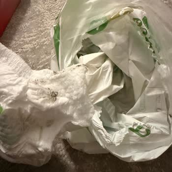 Bebek Bezindeki Siyah Leke Güven Sorununa Yol Açtı