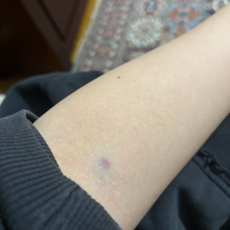 Ümraniye Acil Serviste Saygısız Personel Davranışı Ve Damar Yolu Açma Hatası