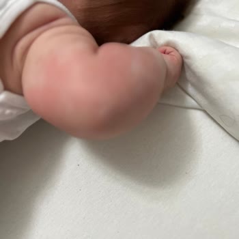 Mustela Baby Products Caused Severe Eczema and Allergic Reactions