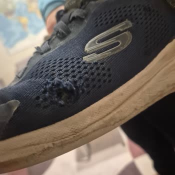 Skechers Bounder 2.0 Ayakkabılarım Üç Ayda Yırtıldı, Şirket Kullanıcı Hatası İddia Ediyor