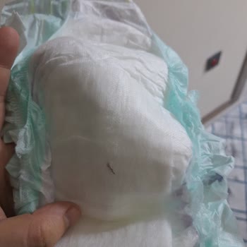 Tekrarlanan Hijyen Sorunu Bebek Bezinde Yabancı Cisim