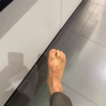 Ayak Yaralayan Bot İçin Üretim Hatası Olmadığı Söylenmesi Ve İade Reddi