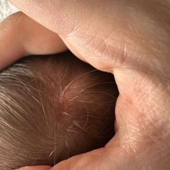 Bebek Şampuanında Kızarıklık Ve Orijinallik Şüphesi