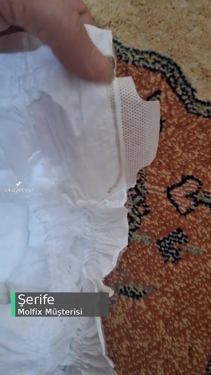 Molfix Bezin İçindeki Kahve Sert Cisim videonun kapak resmi