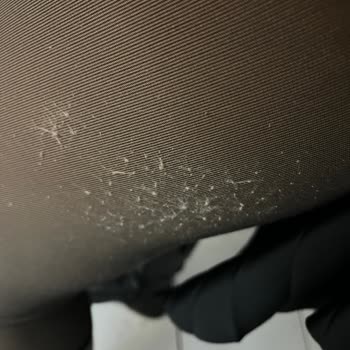 Külotlu Çorap İkinci Kullanımda Yırtıldı, Müşteri Hizmetinden Çözüm Gelmedi