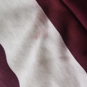 Renk Aşınması Sonrası İade Reddi Ve Suçlayıcı Davranış