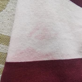 Renk Aşınması Sonrası İade Reddi Ve Suçlayıcı Davranış