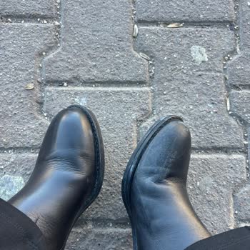 Deichmann Botunda Renk Soyulması Ve Ayak Bileği Kesilmesi, Mağaza Cevapsızlığı