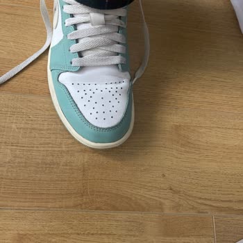 Ayakkabının Yan Açılmaları Kullanıcı Hatası Olarak Bildirildi Ve Bilgi Verilmedi