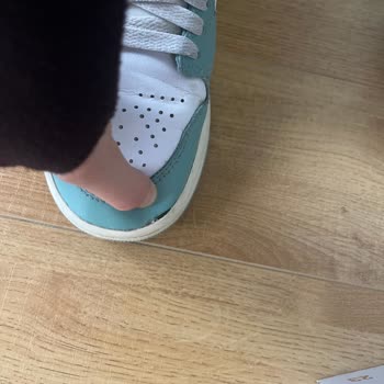 Ayakkabının Yan Açılmaları Kullanıcı Hatası Olarak Bildirildi Ve Bilgi Verilmedi