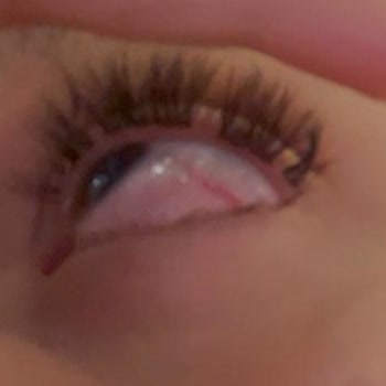 Göz Kirpik Uzatma İşleminde Hijyen ve Kalite Şikayeti