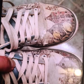 Az Kullanılan Ayakkabının Deri Soyulması Ve Mağazanın Yardım Reddetmesi